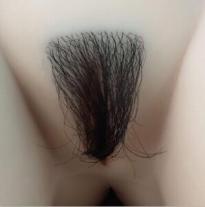 Implanted Black